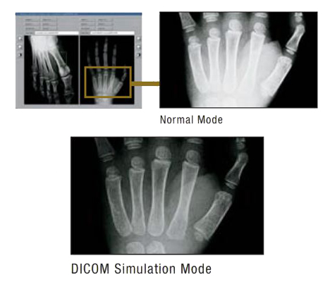 حالت شبیه سازی DICOM