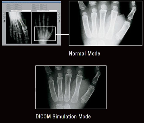 حالت شبیه سازی DICOM 